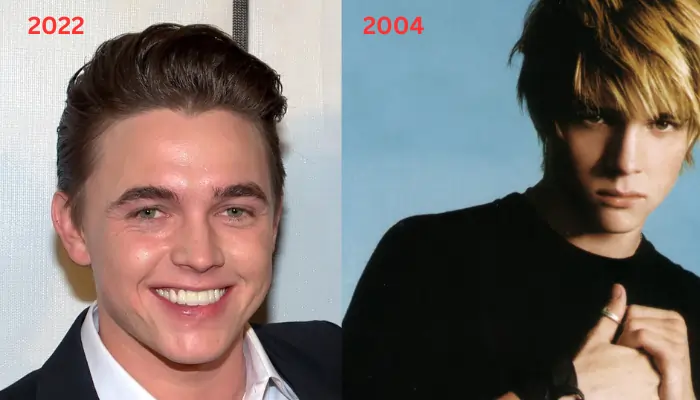 Jesse McCartney’s Plastic Surgery