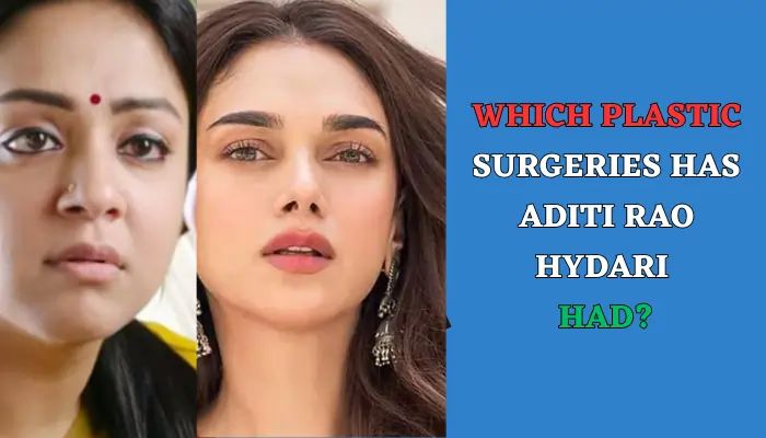 Which Plastic Surgeries Has Aditi Rao Hydari Had
